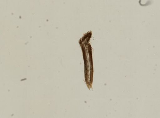 Bithynia tentaculata