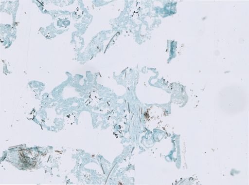 Neofibularia nolitangere