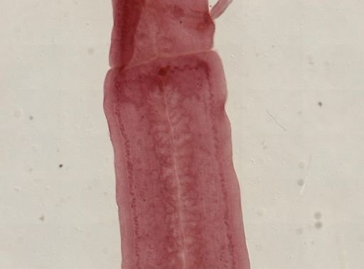Eucestoda