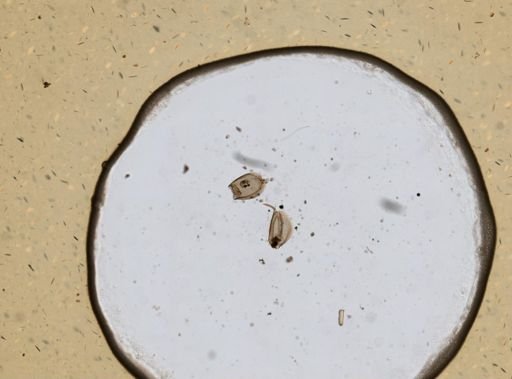 Euchlanis triquetra