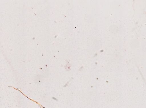 Paramecium