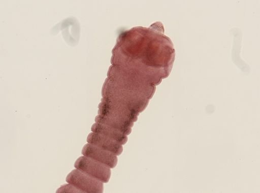 Dipylidium caninum