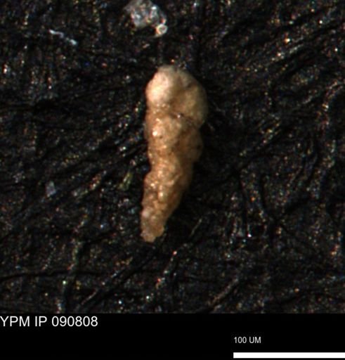 Verneuilina canadensis