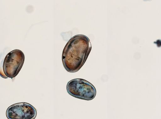 Ostracoda