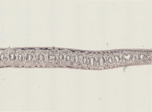 Turbellaria