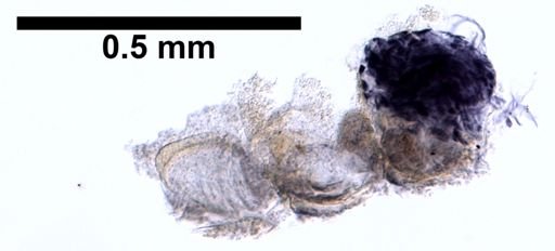 Adelodrilus anisosetosus