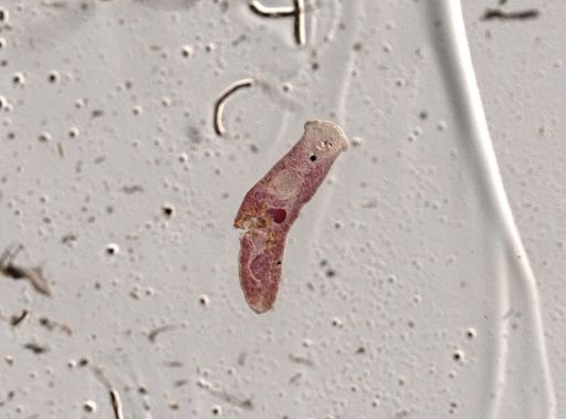 Crepidostomum