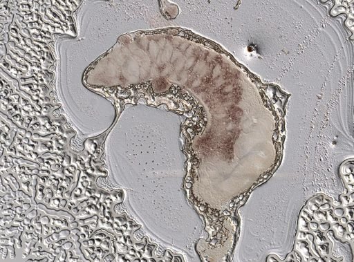 Tetrastemma