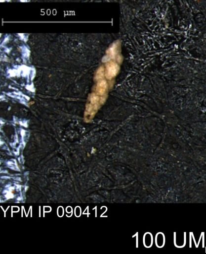 Verneuilina canadensis
