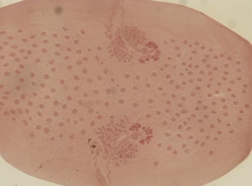 Dipylidium caninum