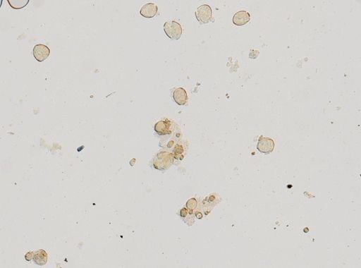 Diphyllobothrium latum