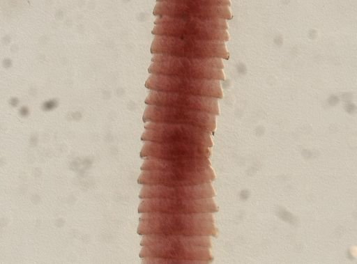 Eucestoda