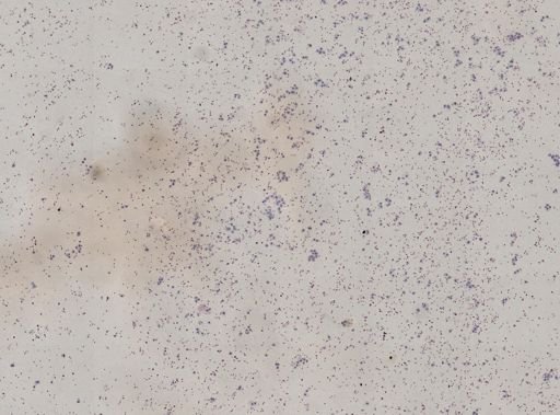 Trypanosoma?