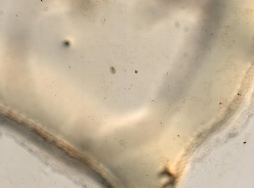 Paramecium