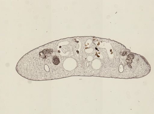 Dicrocoelium dendriticum