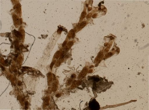 Bugula neritina