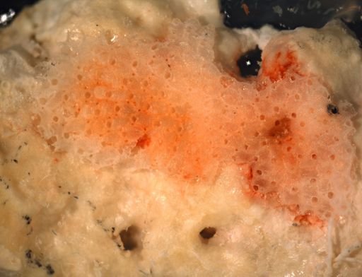 Robertsonidra porifera?
