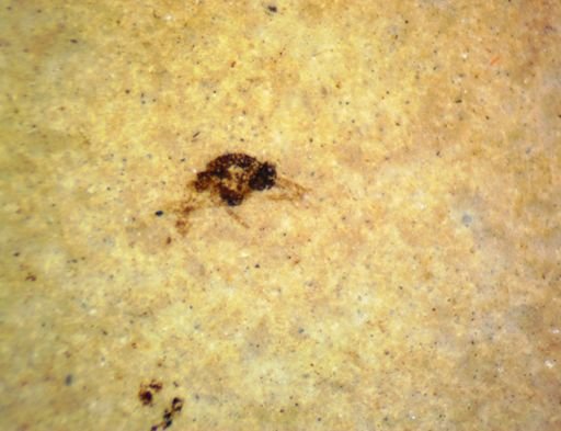undet. Hexapoda