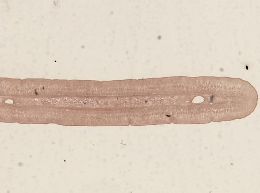 Taenia taeniaeformis