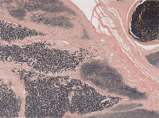 Ichthyosporidium