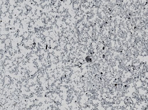 Giardia lamblia