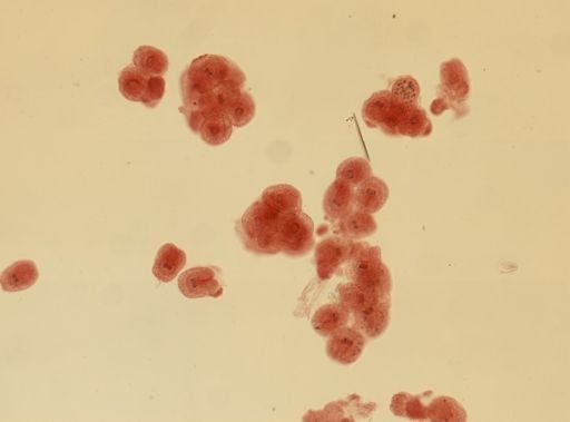 Echinococcus