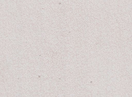 Plasmodium falciparum