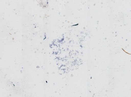 Leishmania donovani