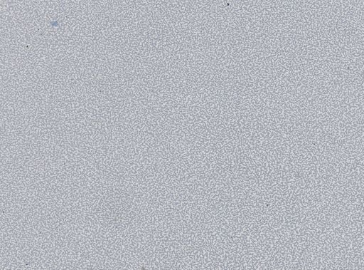 Plasmodium vivax