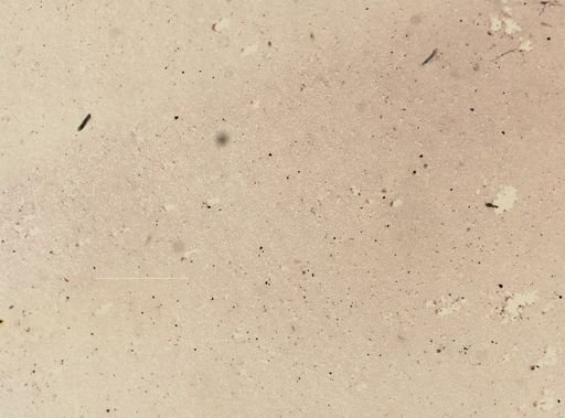 Plasmodium vivax