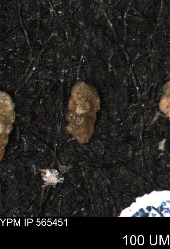 Verneuilina canadensis