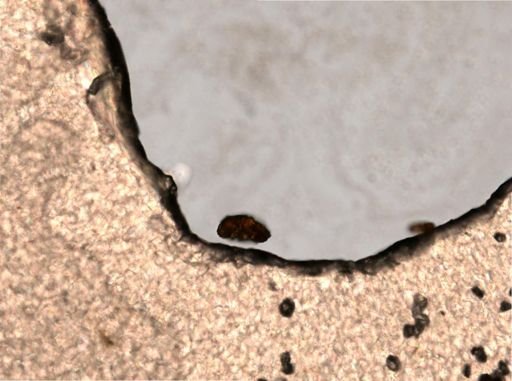 Tardigrada
