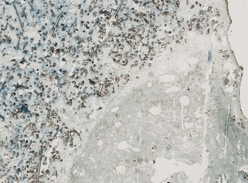 Melophlus sarasinorum