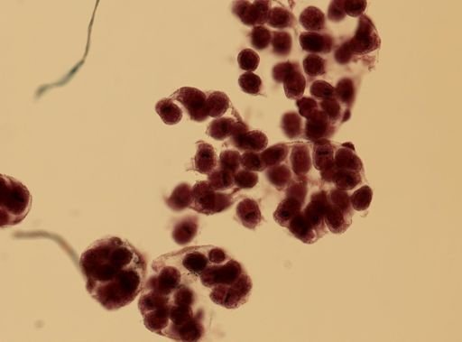 Echinococcus granulosus