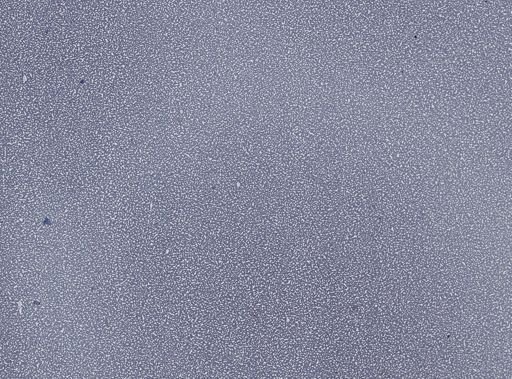 Plasmodium vivax
