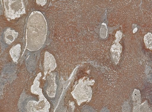 Taenia crassicollis