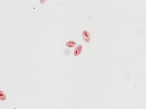 Paramecium