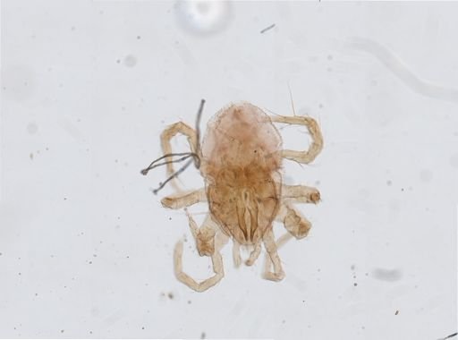 Parasitus coleoptratorum