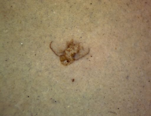 undet. Pterygota