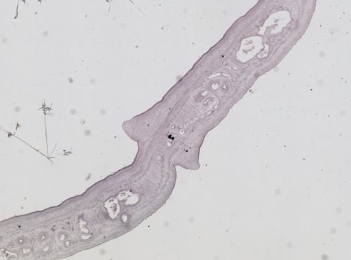 Diphyllobothrium latum