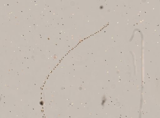 Zygnema