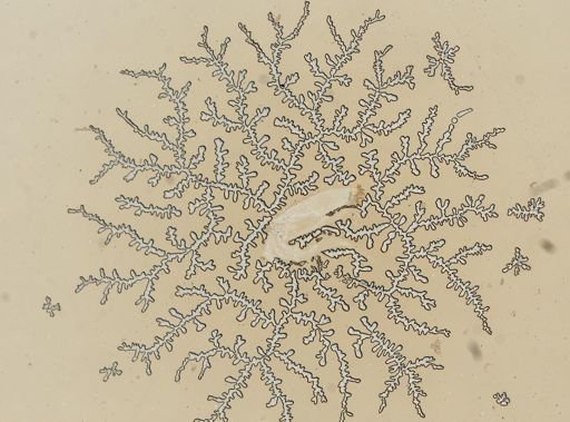 Erichsonella filiformis