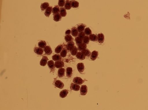 Echinococcus granulosus