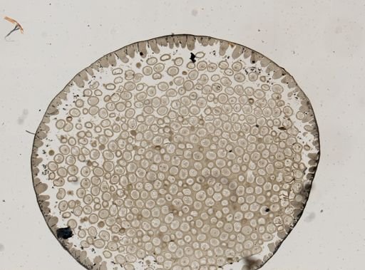 Ascaris megalocephala