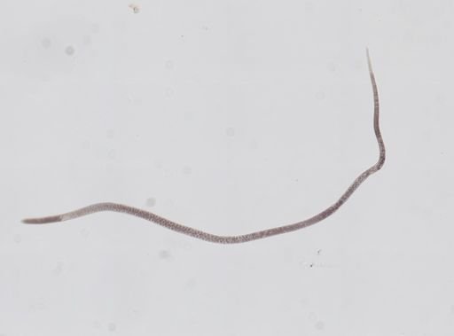 Trichinella spiralis