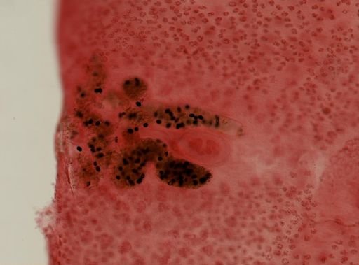 Diphyllobothrium latum