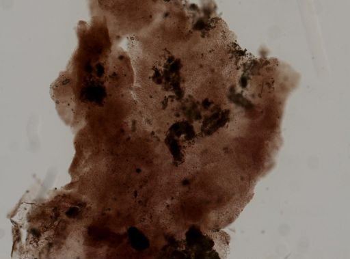 Porifera?