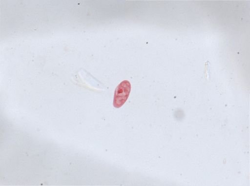 Paramecium aurelia