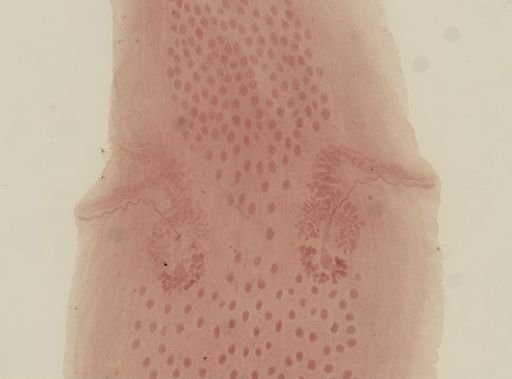 Dipylidium caninum