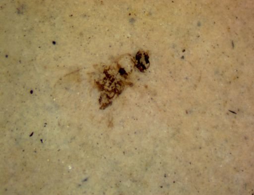 undet. Diptera
